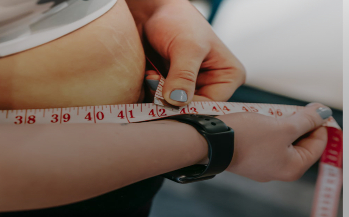 Demasiado gorda para el verano